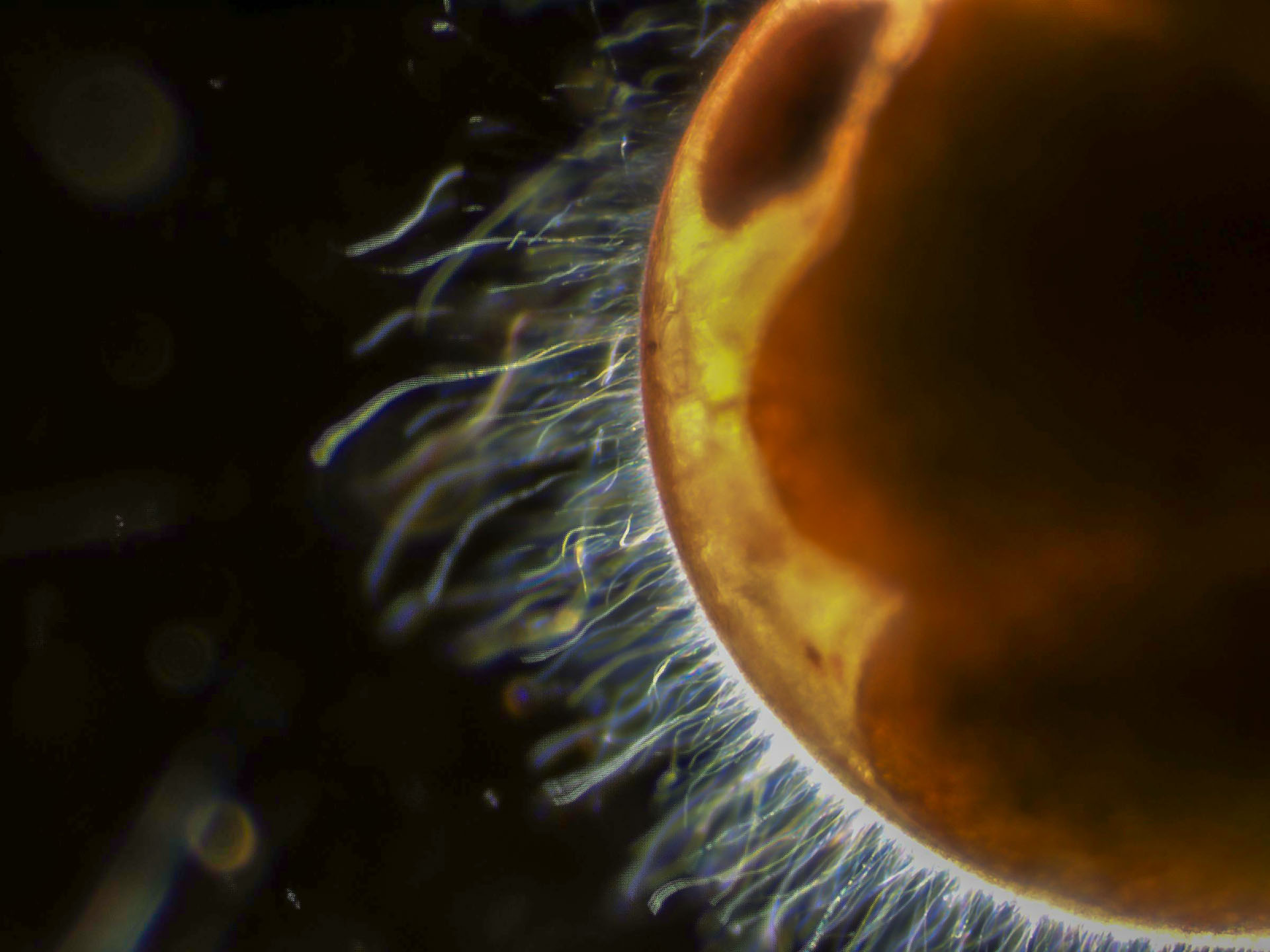 The exterior surface of a late-stage lobster embryo covered by filamentous bacteria at 400x magnification. Photo by J.D. Shields. 