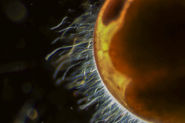 The exterior surface of a late-stage lobster embryo covered by filamentous bacteria at 400x magnification. Photo by J.D. Shields. 